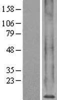 Human MT1X Protein (Over-Expression Lysate Myc-DDK (Flag))
