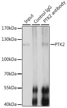 FAK / Focal Adhesion Kinase Antibody