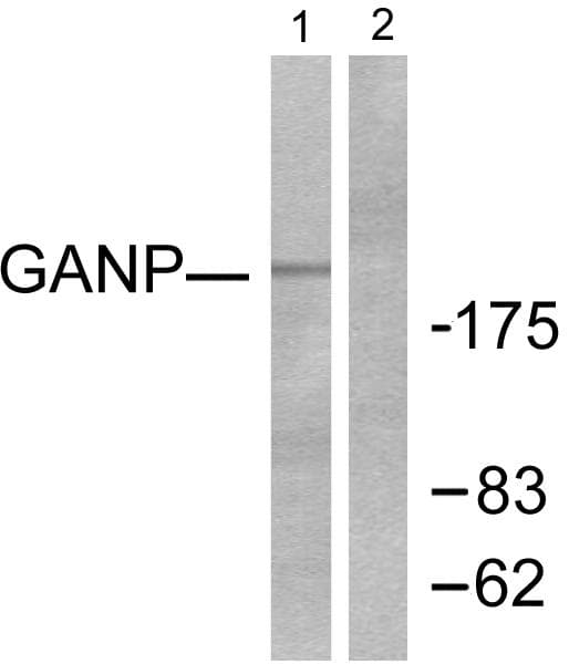 Polyclonal Rabbit anti-Human MCM3AP / GANP Antibody (IHC, WB)