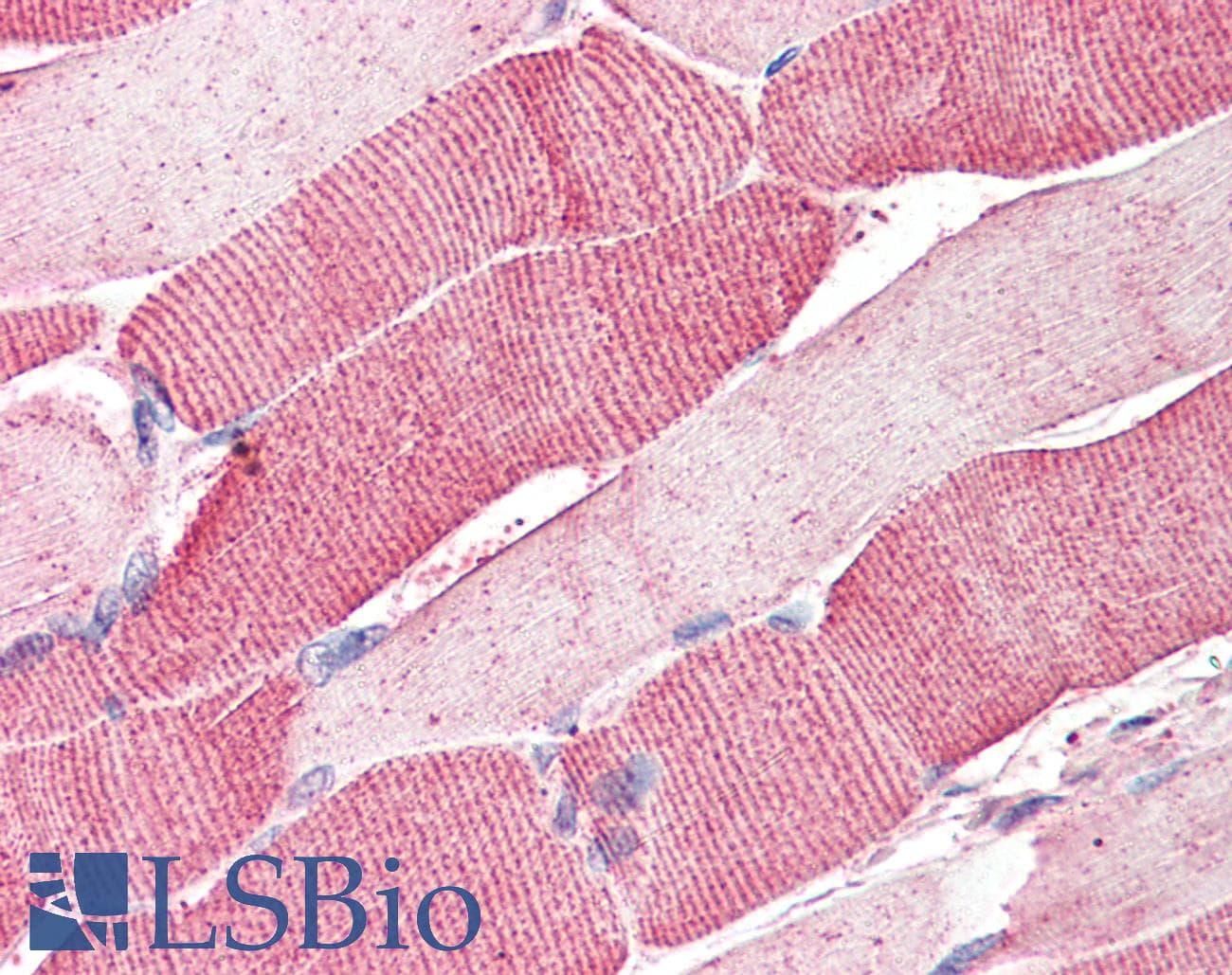 IHC-plus™ ARSB / Arylsulfatase B Antibody (aa359-372)