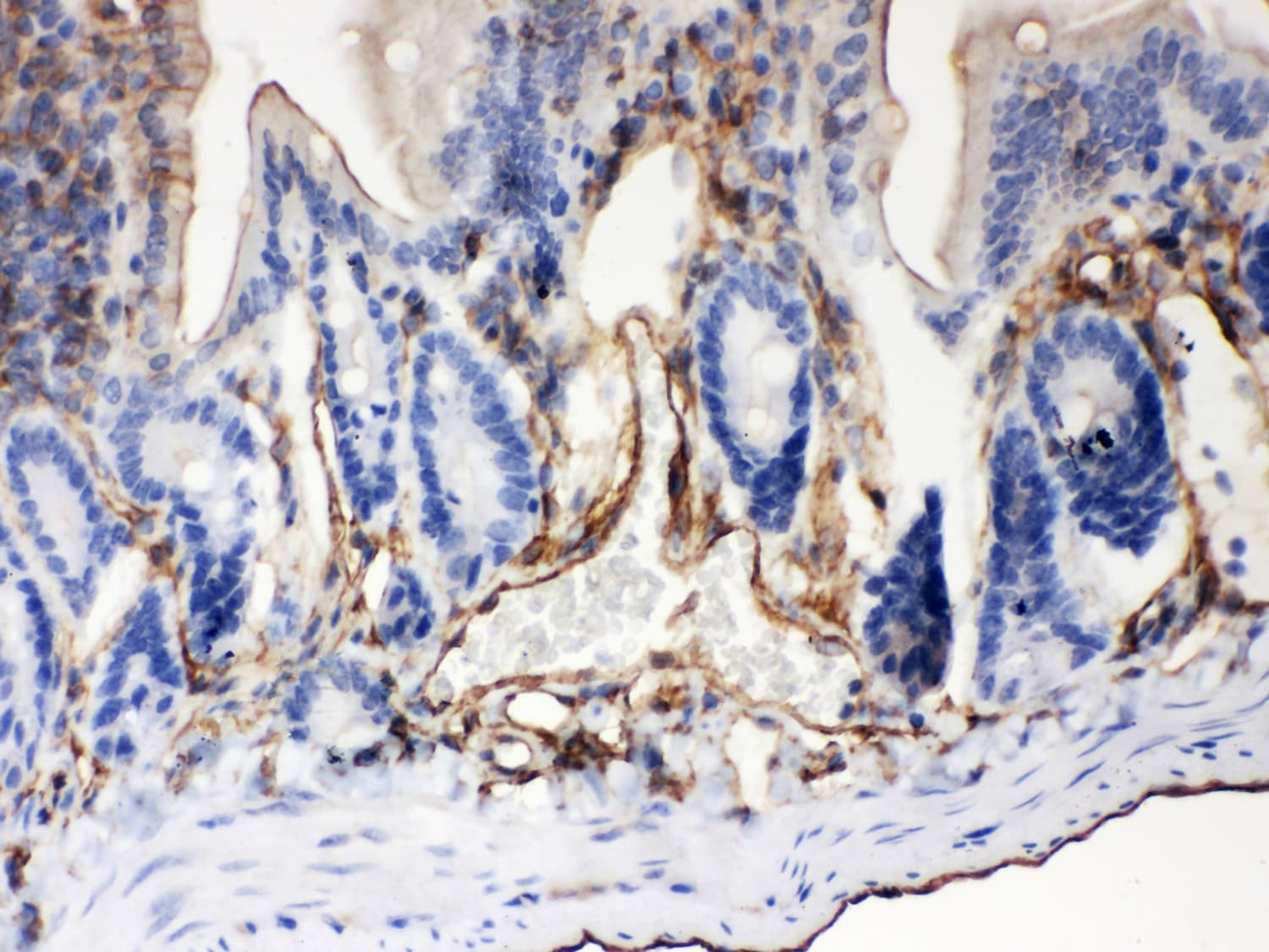 ABCB4 / MDR3 Antibody (aa601-720)