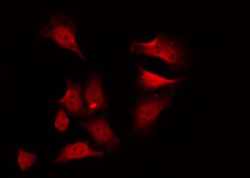 PSKH1 Antibody