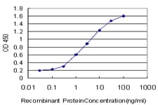 ZRP-1 / TRIP6 Antibody (clone 4B7)