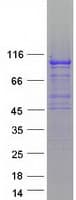 Human SLFN5 Protein (Recombinant Myc-DDK (Flag))