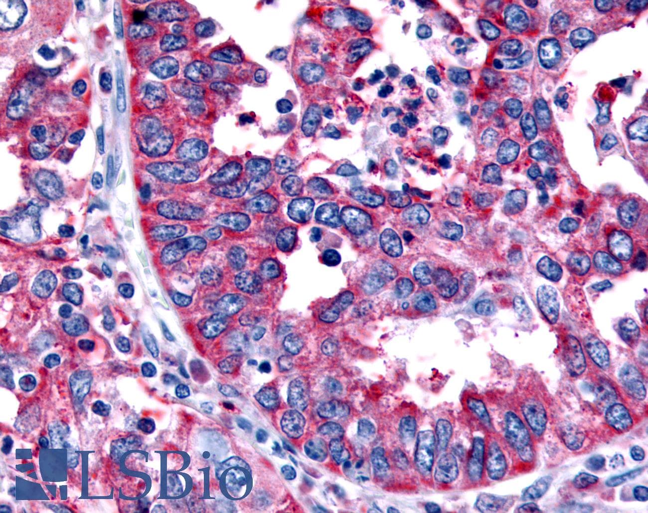 PathPlus™ TRH Receptor / TRHR Antibody (C-Terminus)