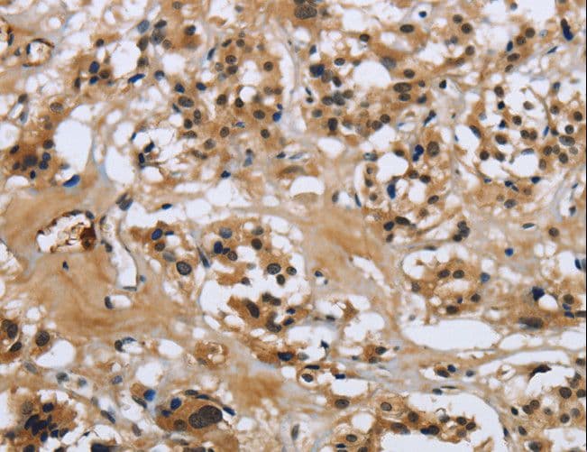 LGALS7 / Galectin 7 Antibody