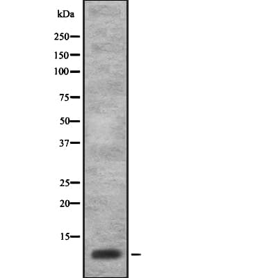 SPINK7 / ECRG2 Antibody