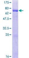 Human BBS5 Protein (Recombinant GST)