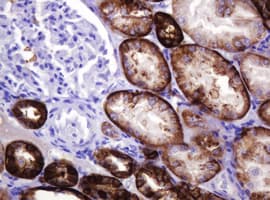 CA12 / Carbonic Anhydrase XII Antibody (clone OTI4G3)