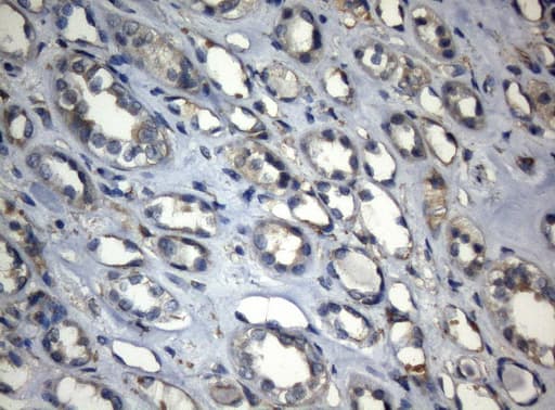 Monoclonal Mouse anti-Human ZNF217 Antibody (clone OTI3G5, aa730-1048, IHC, WB)