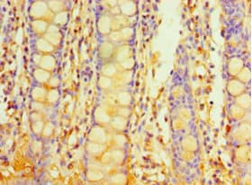 PIGX Antibody (aa42-230)