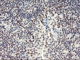 SOLO / SESTD1 Antibody (clone OTI2E7)