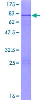 Human ALDH8A1 Protein (Recombinant GST)