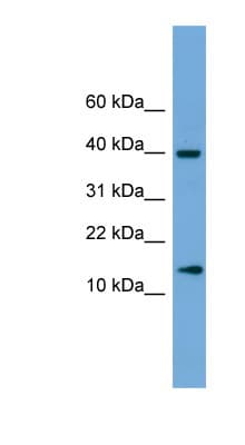Polyclonal Rabbit anti-Human ATP6V1G2 Antibody (C-Terminus, WB)