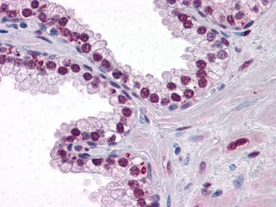 AR / Androgen Receptor Antibody (clone 2H8)