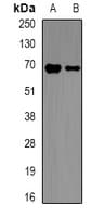 Polyclonal Rabbit anti-Human NCF2 / NOXA2 / p67phox Antibody (IHC, IF, WB)