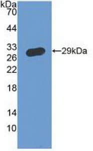 CD119 / IFNGR1 Antibody (aa18-245, APC)