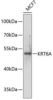 KRT6A / CK6A / Cytokeratin 6A Antibody