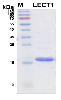 Human LECT1 / Chondromodulin-I Protein (Recombinant 6His, N-terminus)