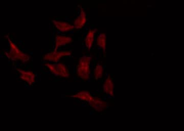 Polyclonal Rabbit anti-Human MMP2 Antibody (IF, WB)