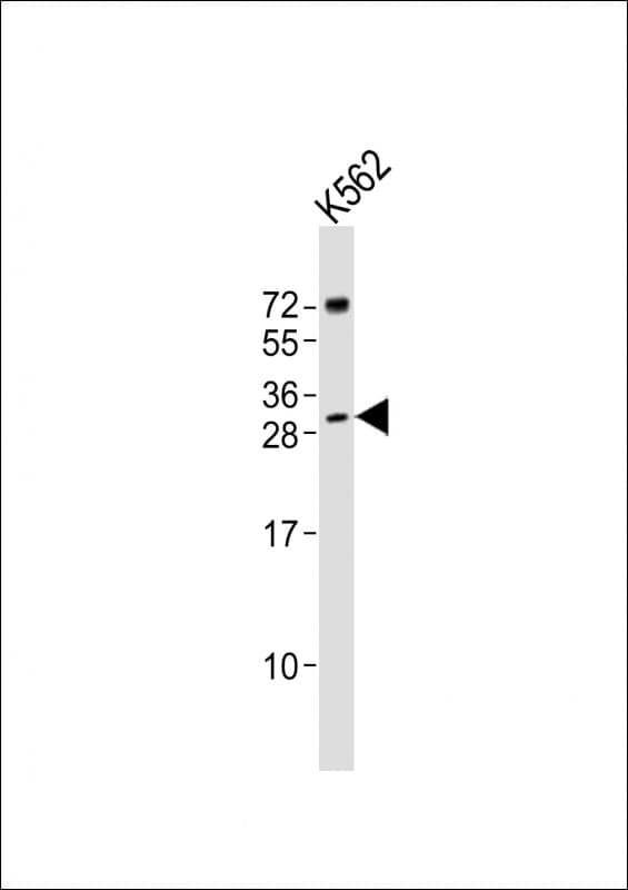 Polyclonal Rabbit anti-Human SRY Antibody (aa81-112, WB)
