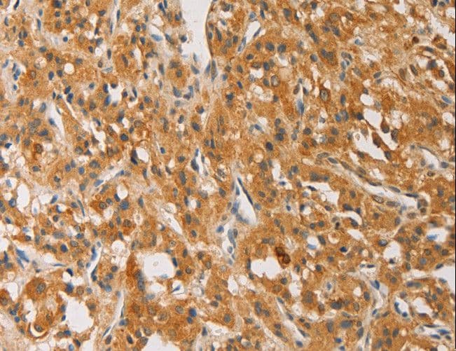 ATG4D Antibody
