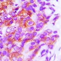 HLA-DPB1 Antibody