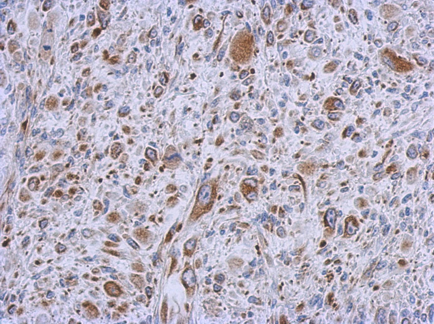 MMACHC Antibody (aa1-218)