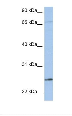 KLK6 / Kallikrein 6 Antibody (aa74-123)