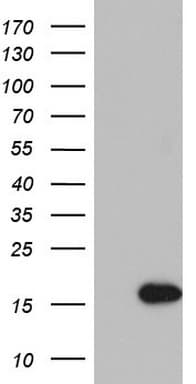 Monoclonal Mouse anti-Human IL1RN Antibody (clone OTI2D5, WB)