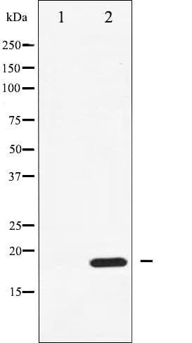 Polyclonal Rabbit anti-Human PPP1R14A / CPI-17 Antibody (phospho-Thr38, IHC, IF, WB)