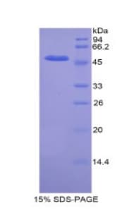 Mouse Kinesin 5A / KIF5A Protein (Recombinant His-GST)