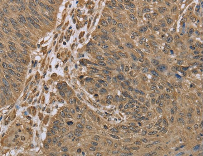 Polyclonal Rabbit anti-Human IKBIP Antibody (IHC)