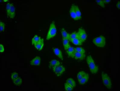 CHEMR23 / CMKLR1 Antibody