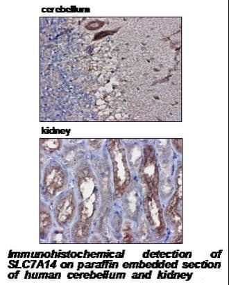 Polyclonal Rabbit anti-Human SLC7A14 Antibody (IHC, WB)