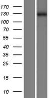 ZMYM1 Protein (Over-Expression Lysate Myc-DDK (Flag))