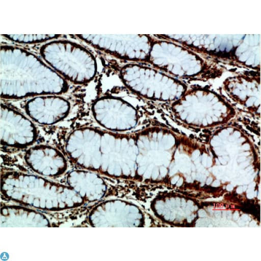 Polyclonal Rabbit anti-Human HSPA5 / GRP78 / BiP Antibody (WB)