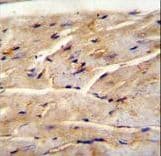 Polyclonal Rabbit anti-Human FAM82B Antibody (aa76-104, IHC, WB)