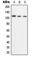 HIF1A / HIF1 Alpha Antibody (Internal)