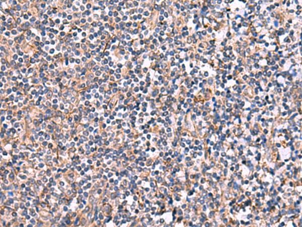 INPP5B Antibody