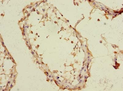 TMEM93 Antibody