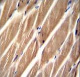 PIP5KL1 Antibody (aa57-86)