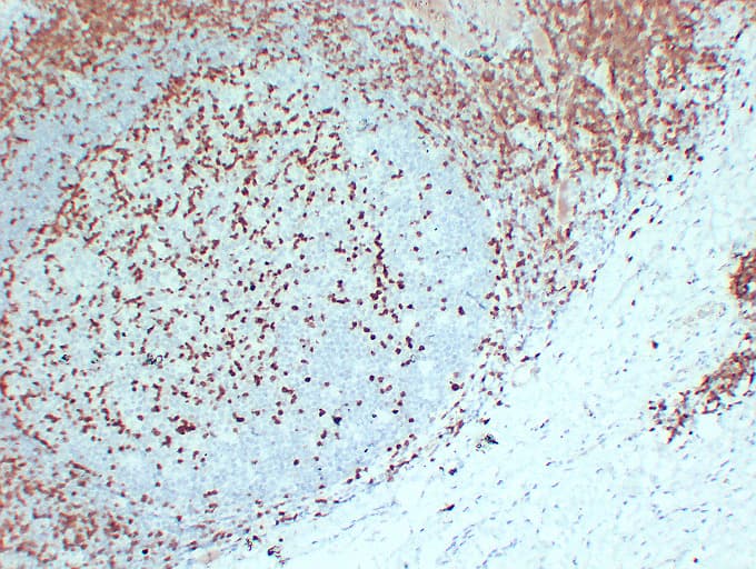 ZAP70 Antibody (clone ABT-ZAP70)