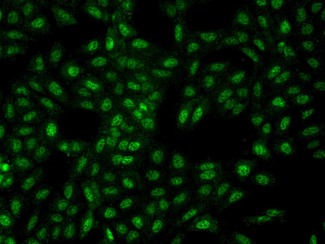 Polyclonal Rabbit anti-Human C2orf61 Antibody (IF)