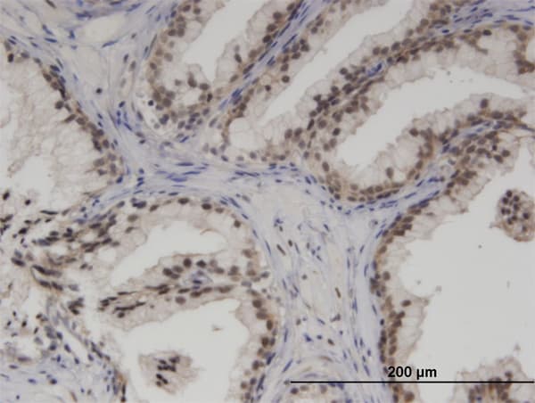 SMARCA5 / SNF2H Antibody (clone 3F4)