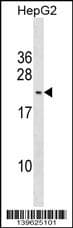 Polyclonal Rabbit anti-Human PMS2L3 Antibody (aa 82-107, C-term, WB)
