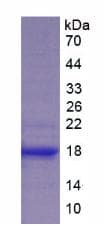 Pig F8 / FVIII / Factor VIII Protein (Recombinant His)