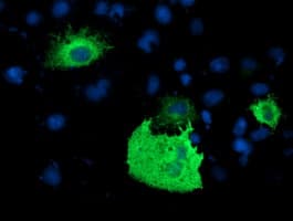 PDE1B Antibody (clone OTI6E4)