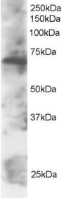 IHC-plus™ SWAP70 Antibody (aa572-585)