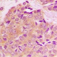 Polyclonal Rabbit anti-Human YWHAZ / 14-3-3 Zeta Antibody (phospho-Ser58, IHC, IF, WB)